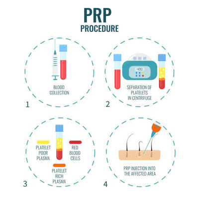 قیمت خوب Veterinary Medicine:** Process animal blood for PRP therapies in equine and canine sports medicine. آنلاین